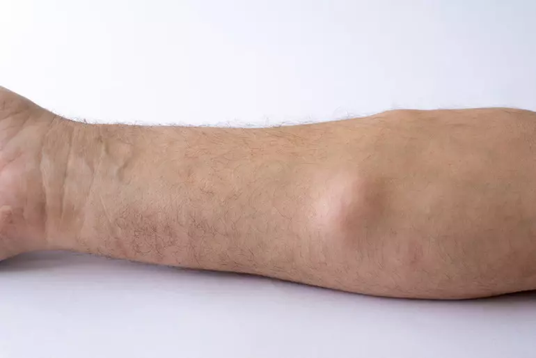 1fc2c8f19feb8be3b87204f1fbc8e0cc1717538735