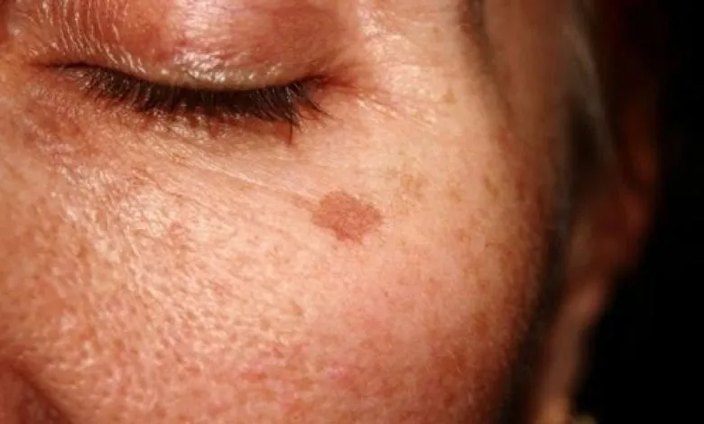 Lkrgu9gcf04im0ruoaifs3luljkp9kklwua7ujfx 542 962a07bf