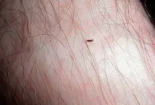 Uk Zemlani Blohi V Budinku Ak Pozbutisa Vid Parazitiv V Tomu Cisli Ak Vivesti Z Kvartiri 12