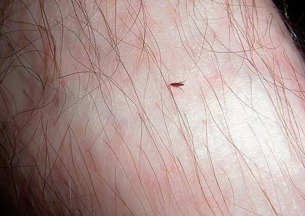 Uk Zemlani Blohi V Budinku Ak Pozbutisa Vid Parazitiv V Tomu Cisli Ak Vivesti Z Kvartiri 12