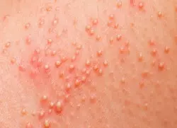 Visip Na Polovih Organah Mujchin1